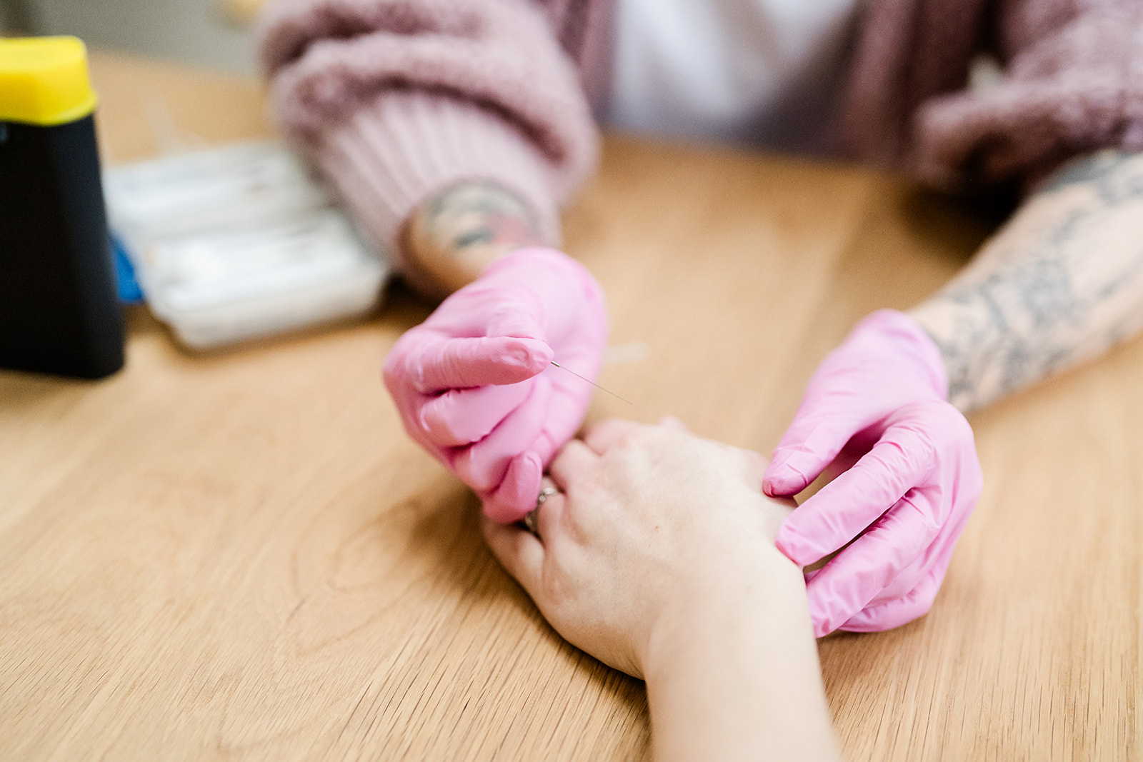 Pregnancy acupuncture provided by a trained midwife